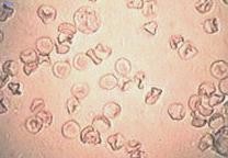 rythrocytes normaux